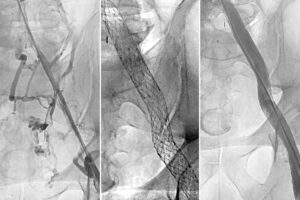 Radiographic images of veins