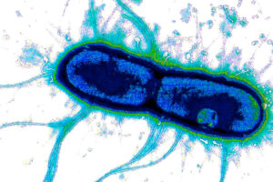 An electron microscopy image of enterotoxigenic E. coli