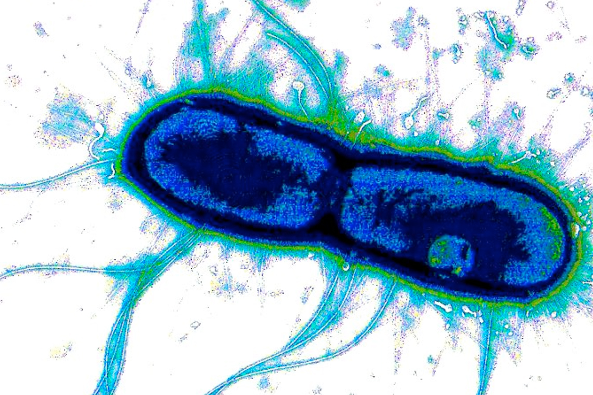 Researchers find a common weakness in major gut pathogens