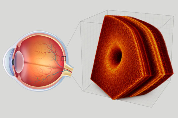 New AI tools could help eye doctors diagnose retinal disease faster