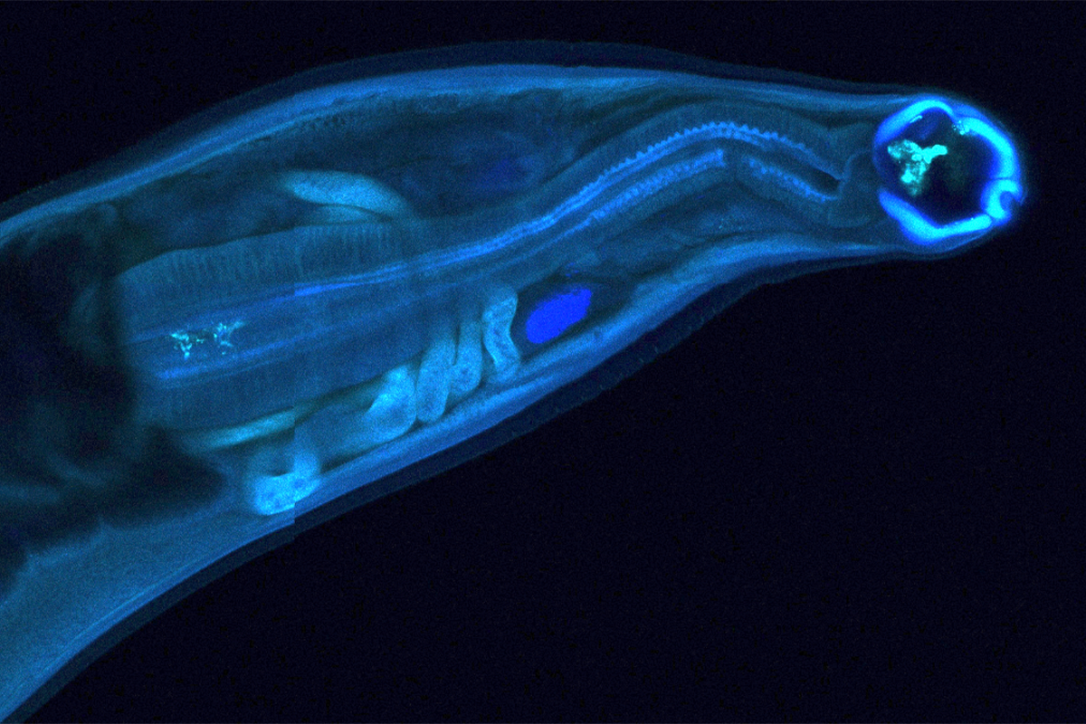 Genetically modified hookworms produce and deliver therapeutics