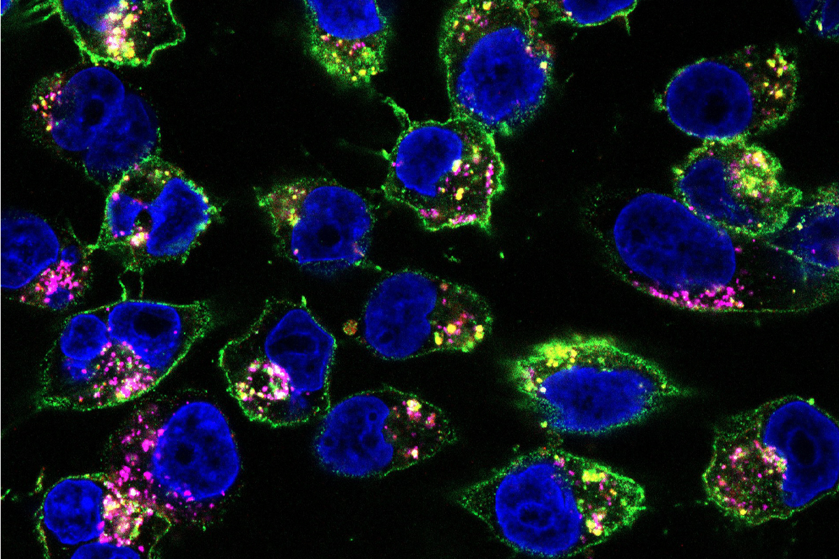 New approach to designing drugs supercharges cancer medication