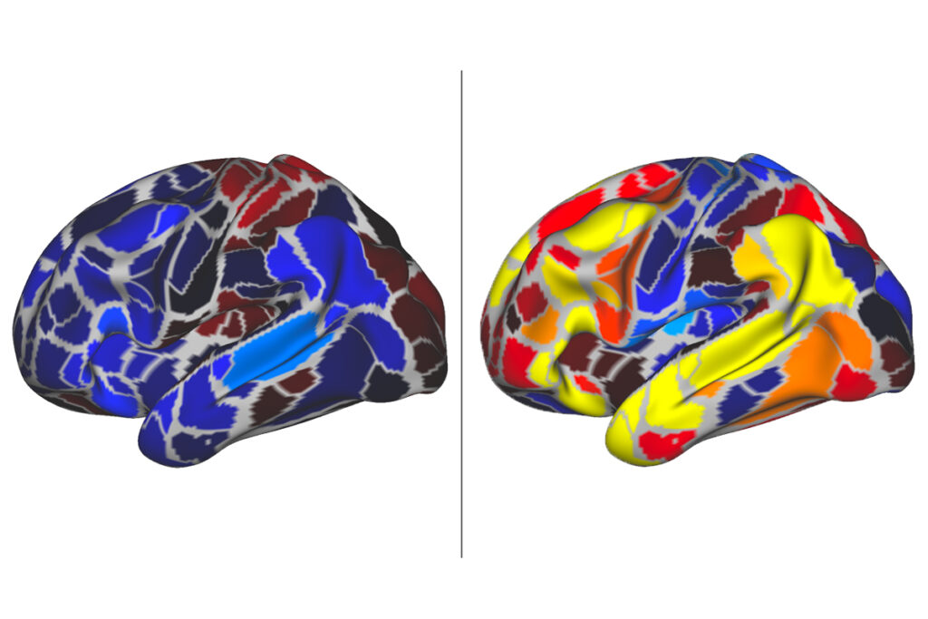 Two colorful images of the human brain appear side by side