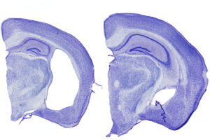 Brain segments