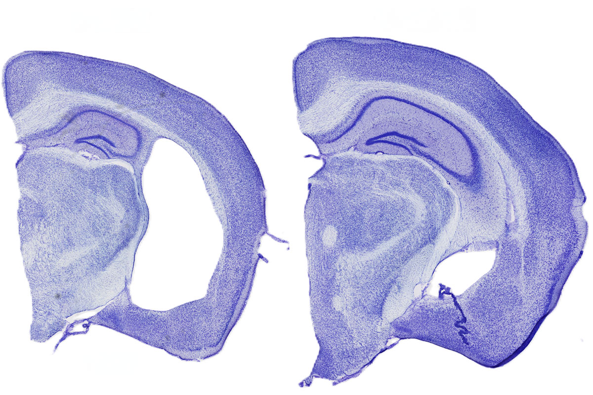 Key path to Alzheimer’s-like brain damage starts outside the brain