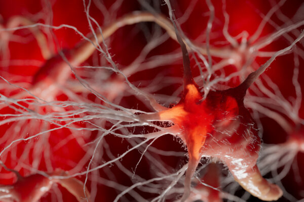 Blocking immune cells’ path into brain limits neurodegeneration