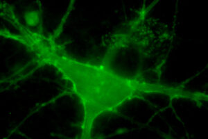 Neurons