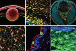 Six fluorescent micrograph images of eyes, neurons and other tissues