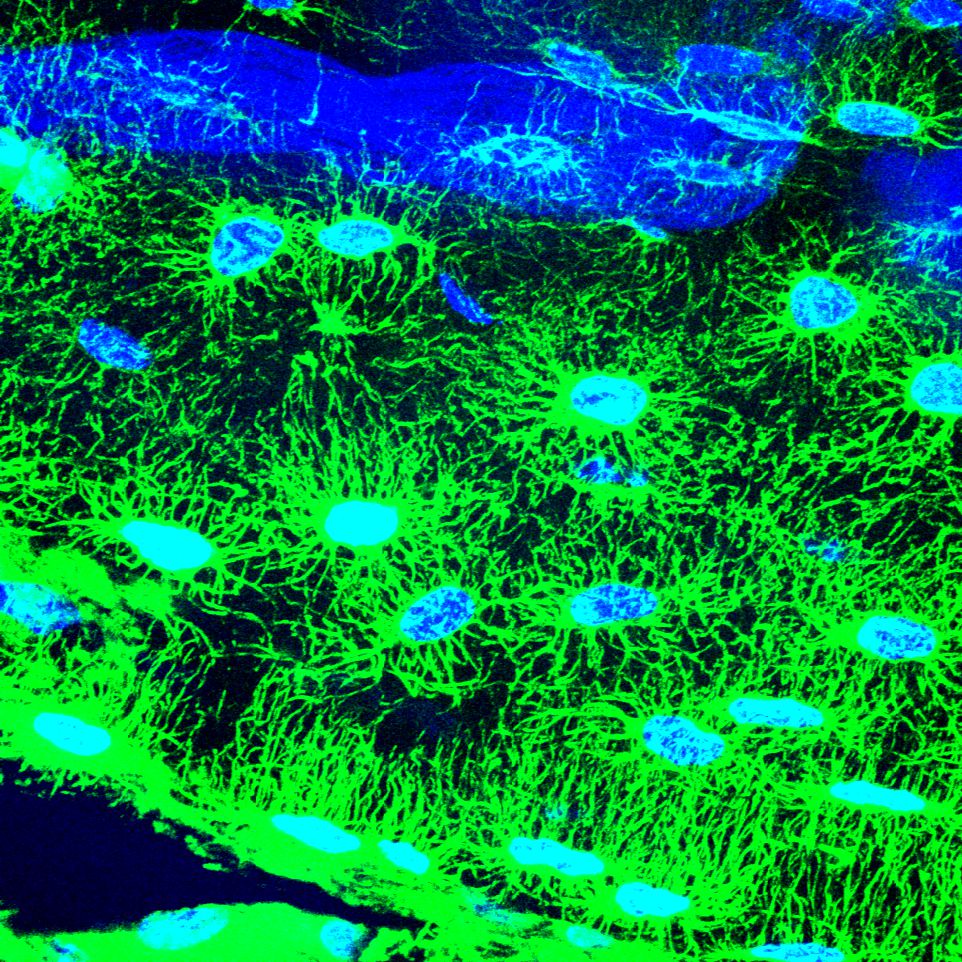 Micrograph of dendrites in bone stained green