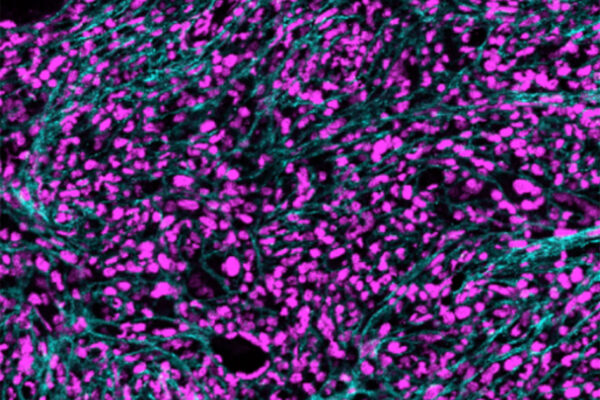 $11.7 million from NIH supports research on inflammation in blood cancers