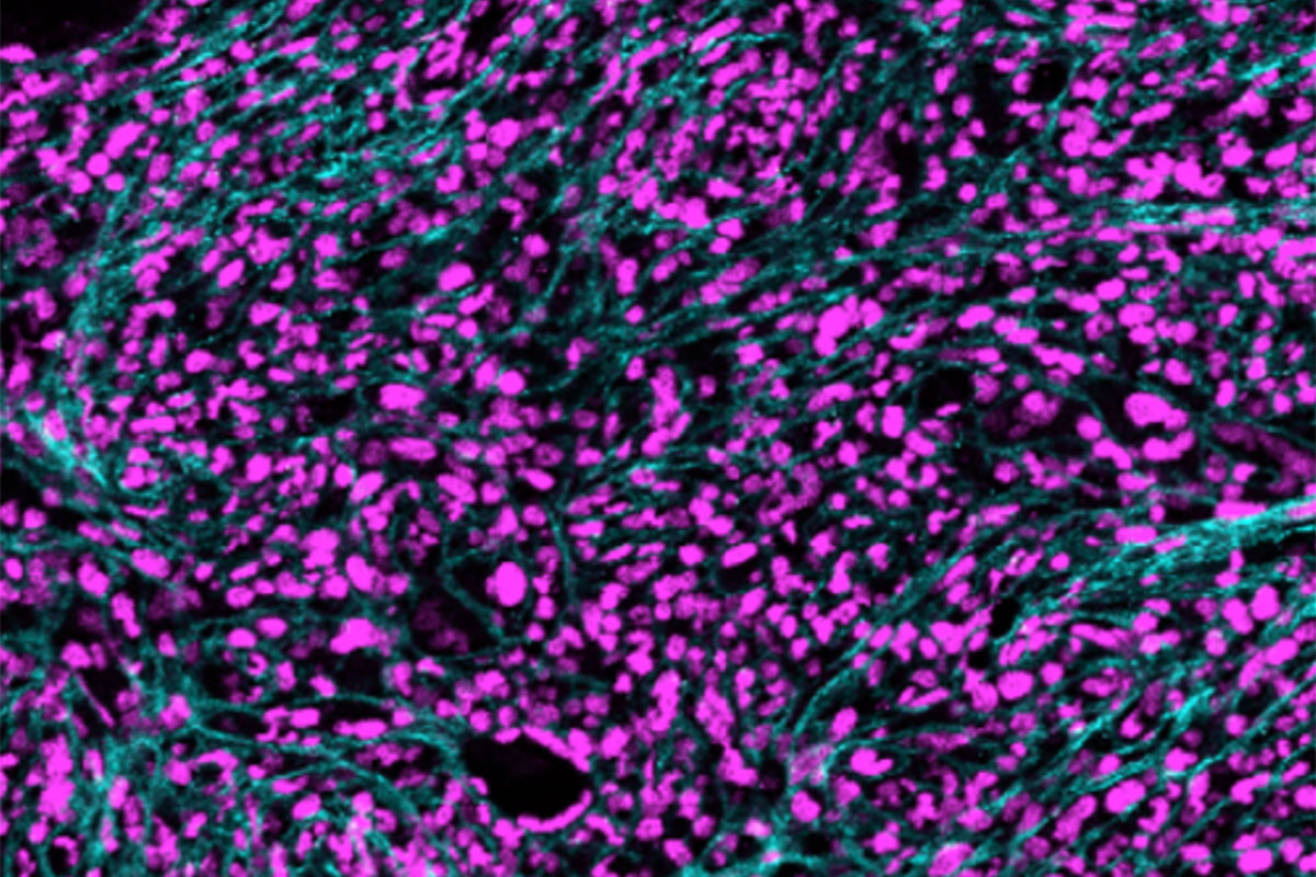 $11.7 million from NIH supports research on inflammation in blood cancers