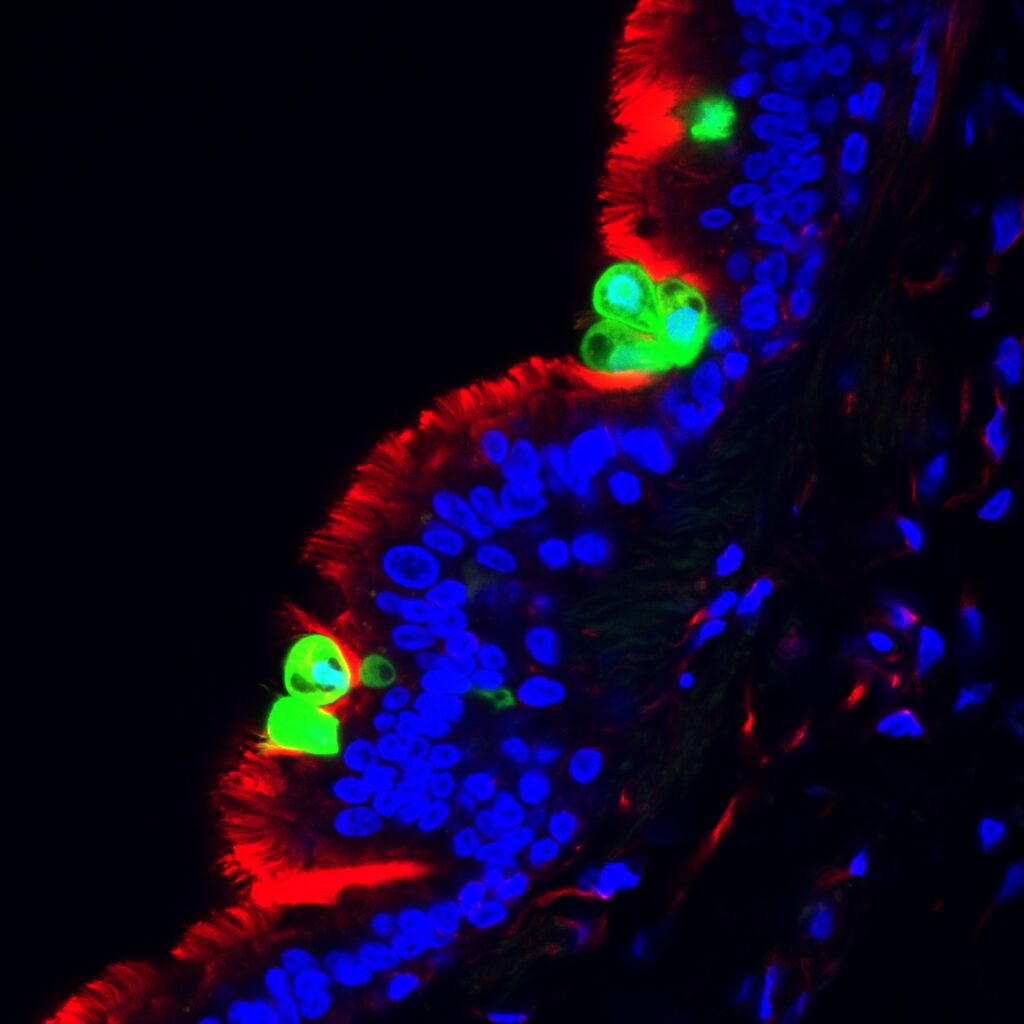 slice of a human infant lung infected with RSV