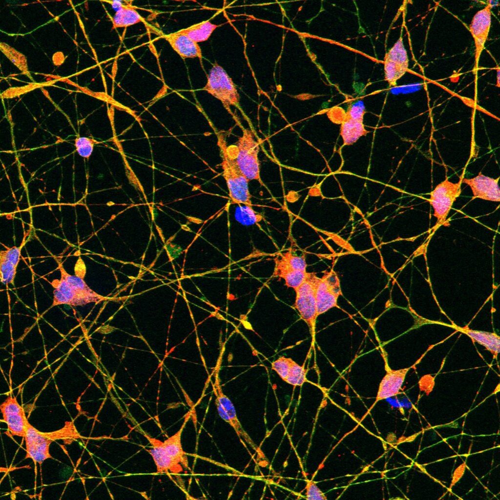 Fluorescently labeled neurons