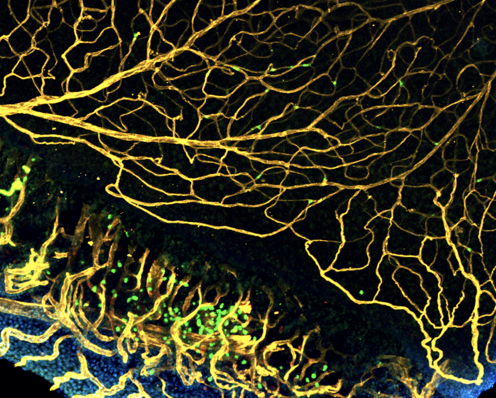 Immune cells (green) from patients with eye inflammation