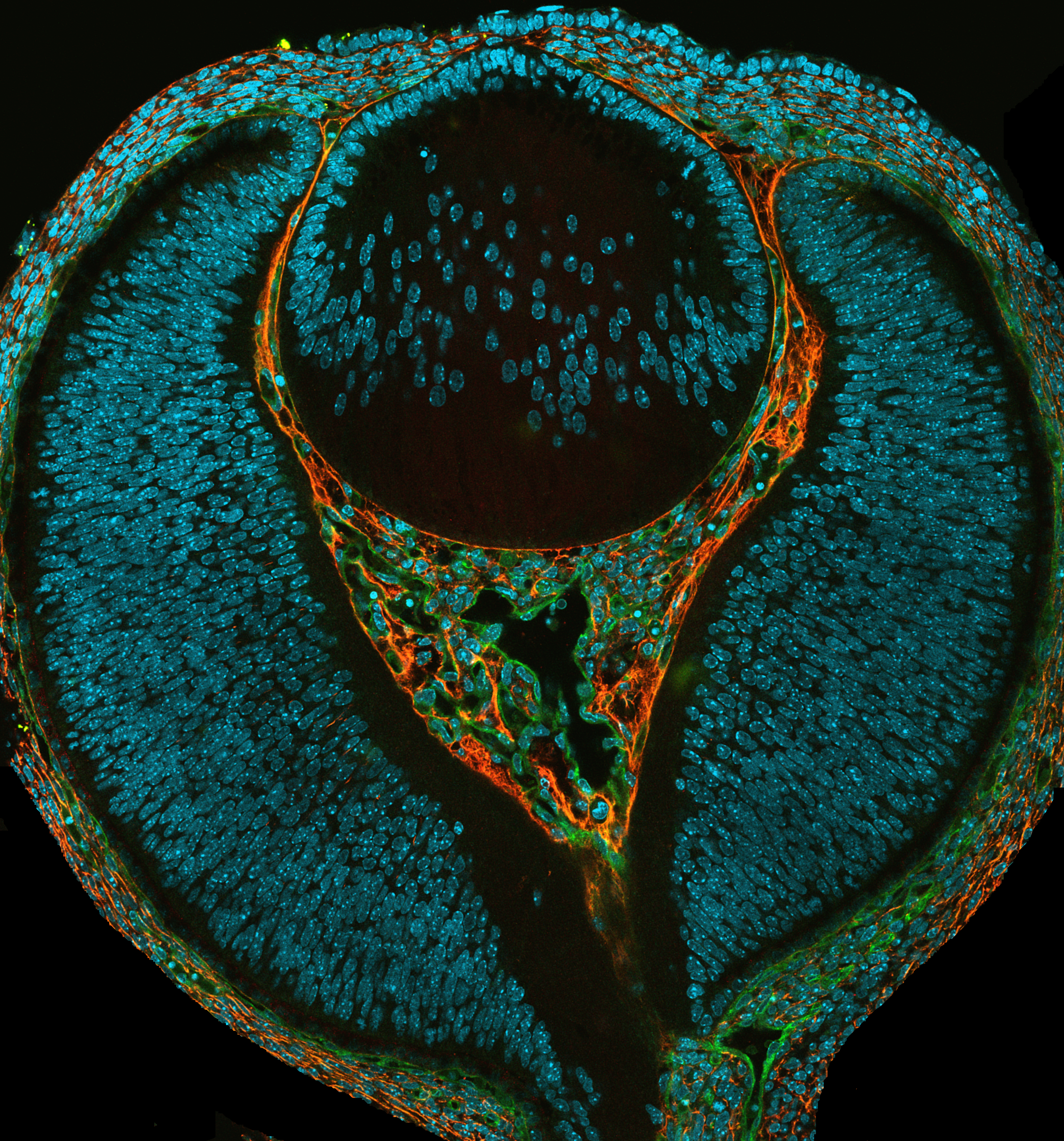 Micrograph of developing mouse eye
